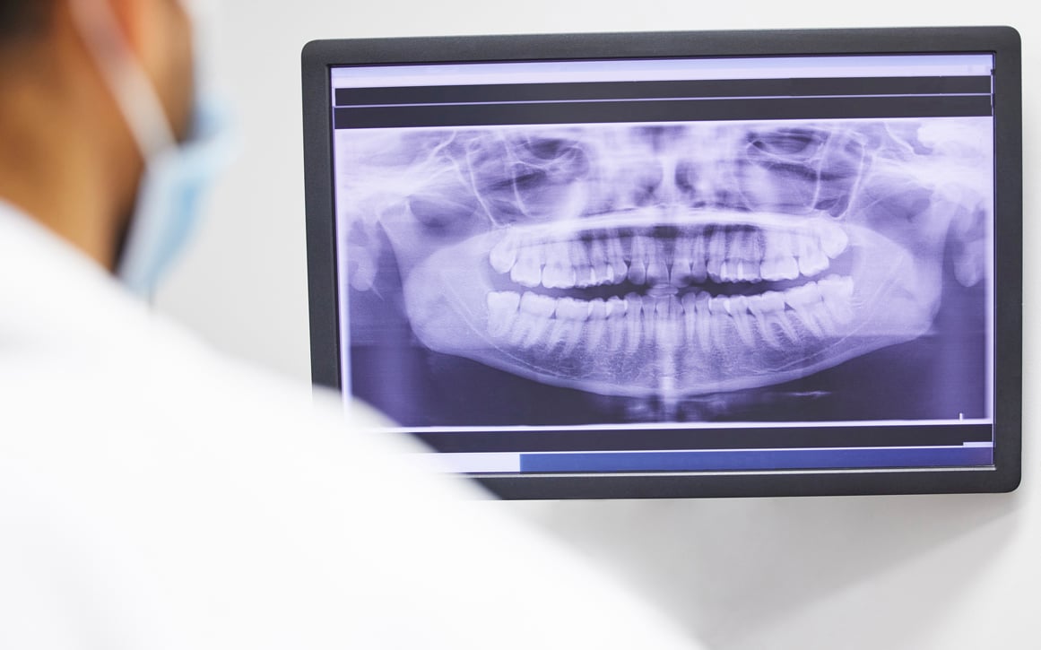 Curve Dental Software for Independent Practices
